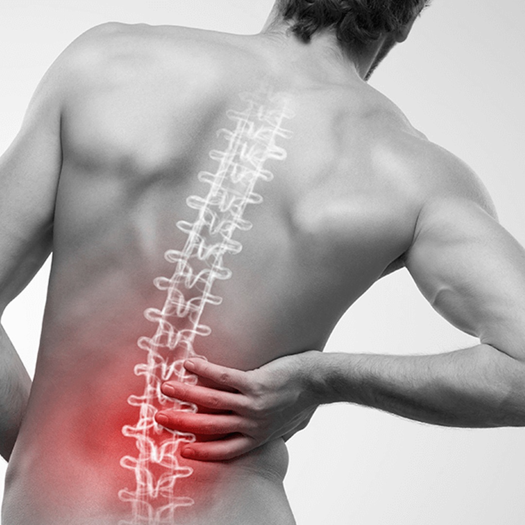 Vertebroplasty / Kyphoplasty